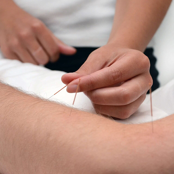 Sports Physio Treatment